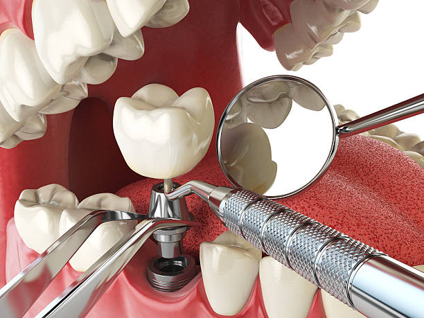 Best Walk-In Emergency Dentist in Farmerville, LA